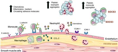 Endothelial cell dysfunction: Implications for the pathogenesis of peripheral artery disease